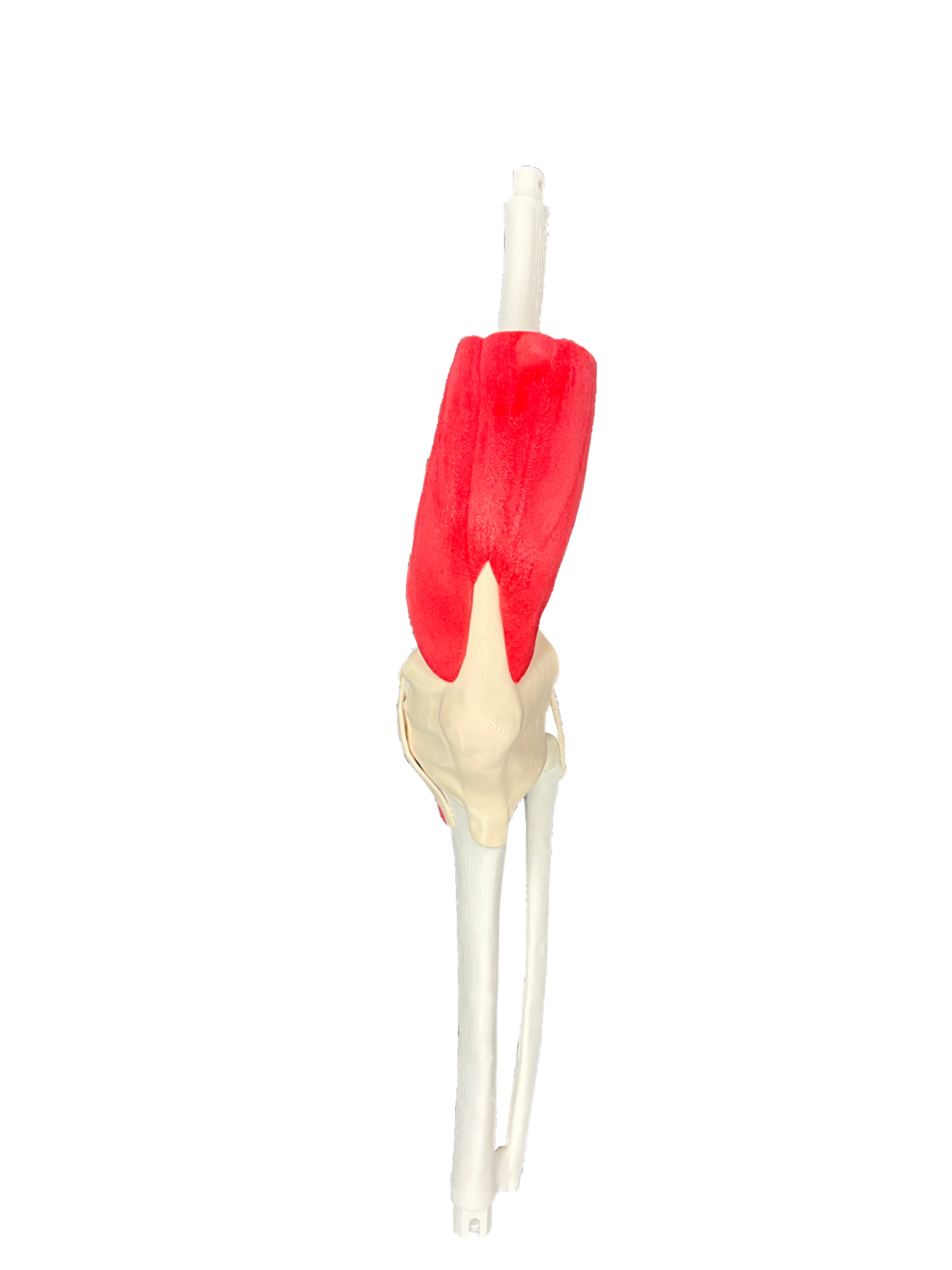 Comprehensive Knee – Casted