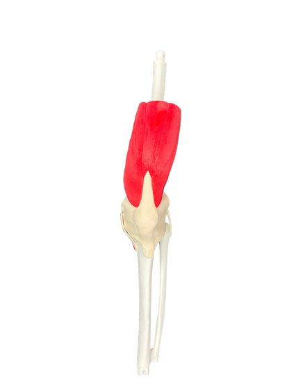 Comprehensive Knee – Casted
