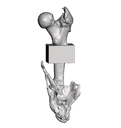 Mid Femur Amputee 2