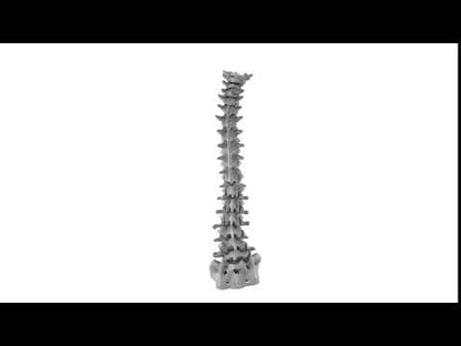 Adult Degenerative Spine