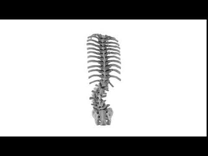 Adult Degenerative Scoliosis Lateral Approach Bundle