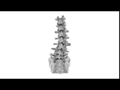 Lumbar Degenerative Scoliosis 1