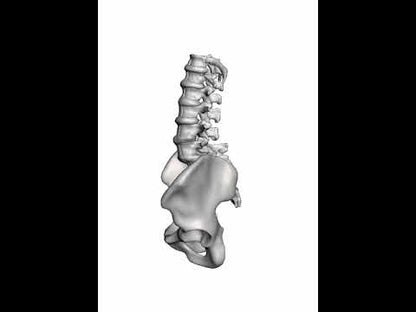 Lumbar Degenerative Spondylolisthesis