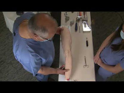 Varus Knee – 10 Degree Deformity