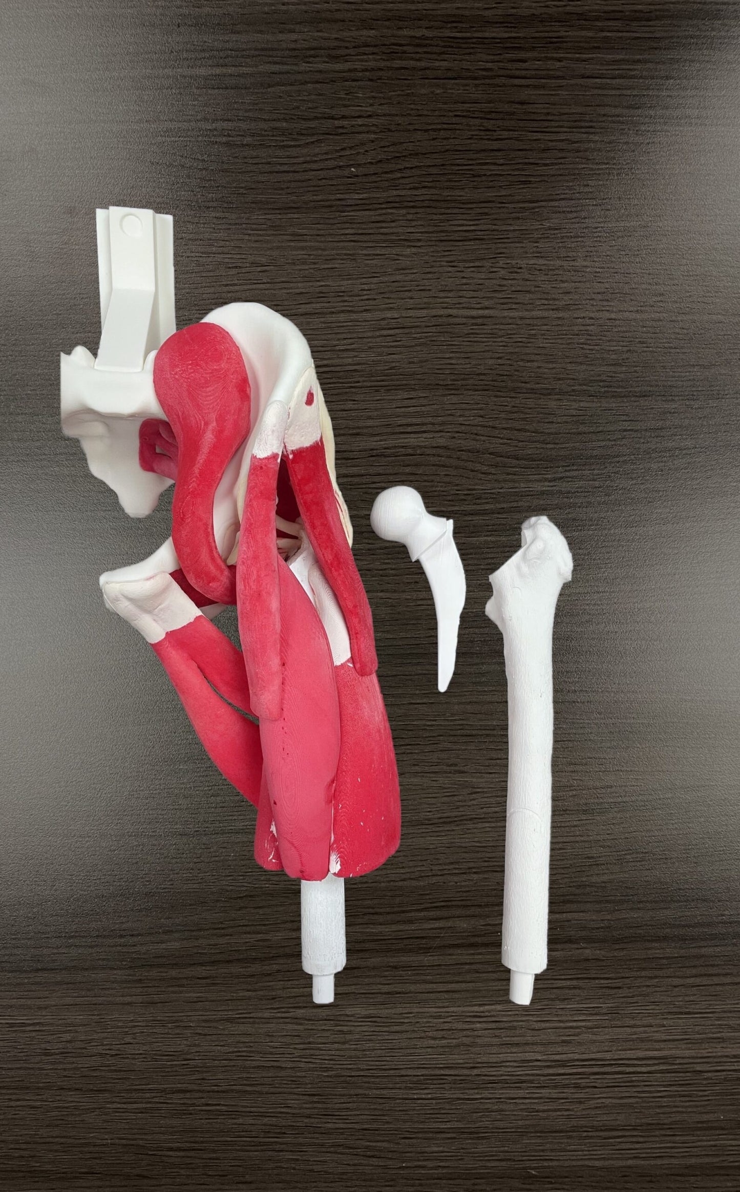 Zimmer Pre-Instrumented Bilateral Hip