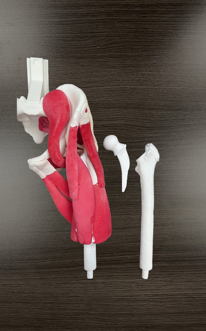 Zimmer Pre-Instrumented Bilateral Hip