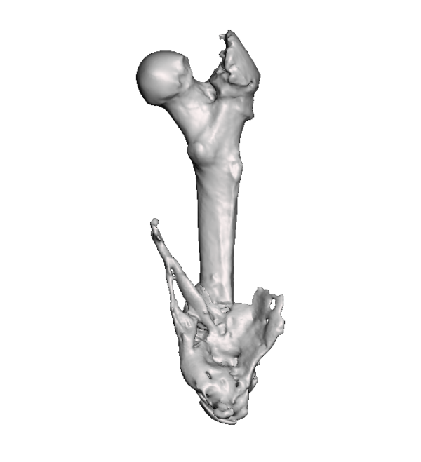 Mid Femur Amputee 2