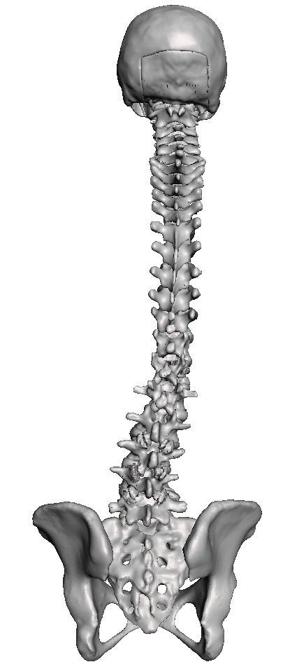 Occiput to Sacrum Trauma Spine