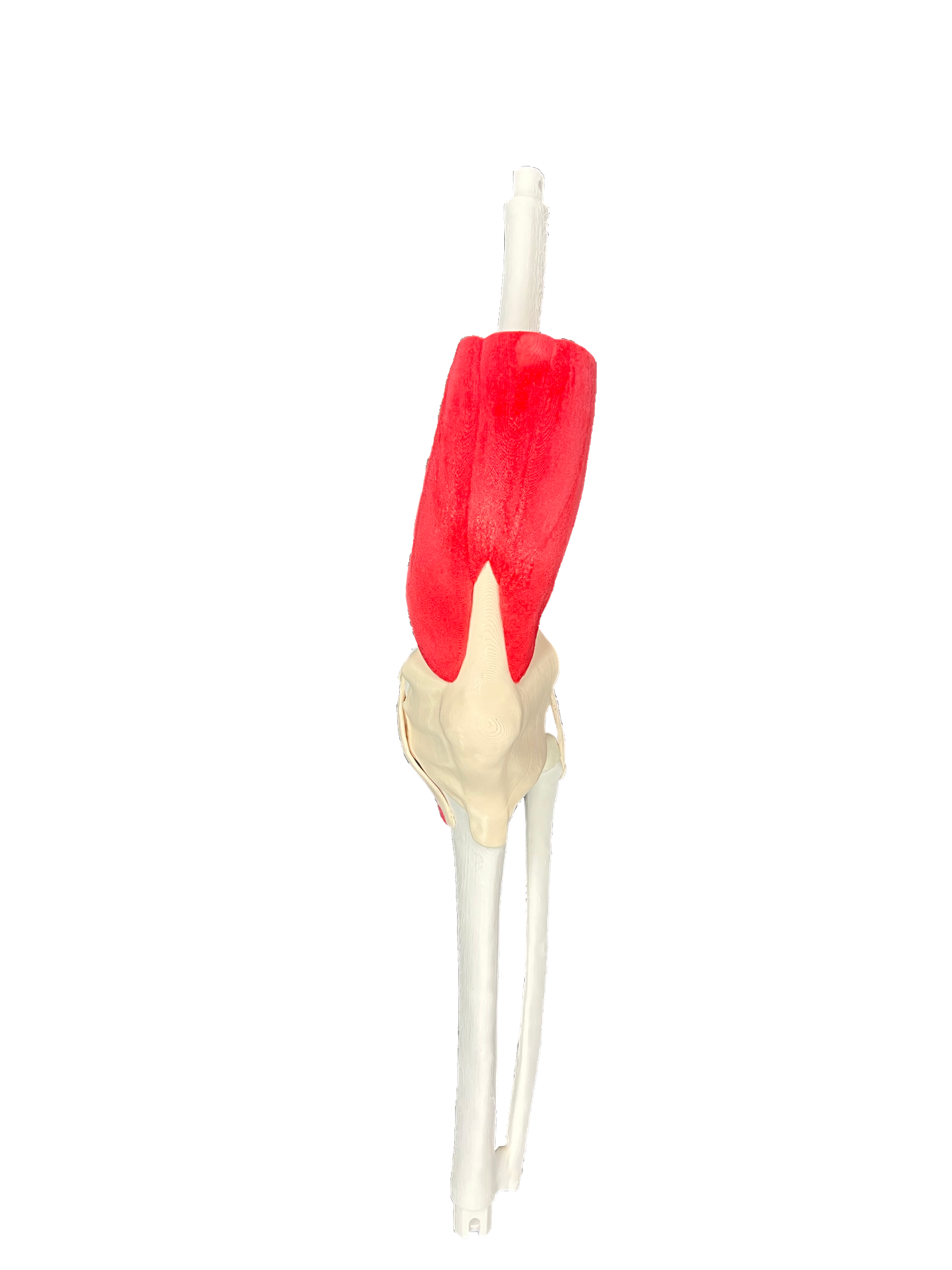 Comprehensive PKA Stryker Knee for Mako – Casted