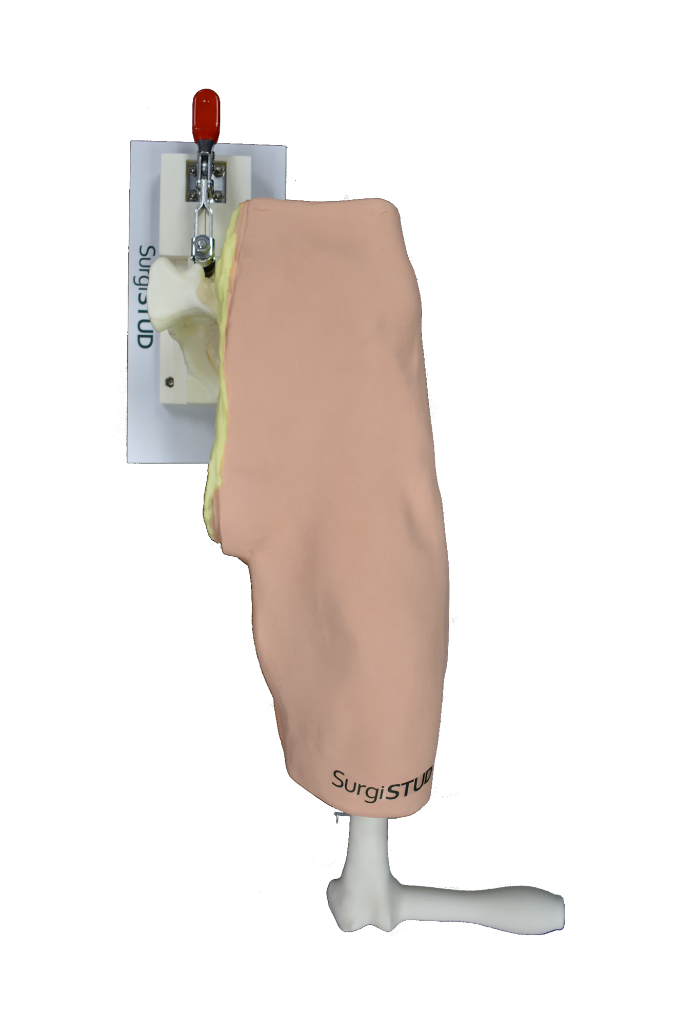 Zimmer Anterior Hip – Casted for Hip Insight Technology