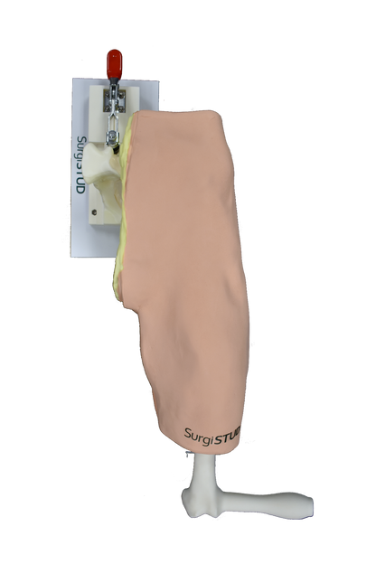 Zimmer Anterior Hip – Casted for Hip Insight Technology